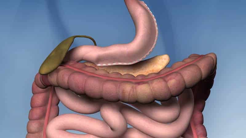 When can I drink alcohol after gastric sleeve surgery?