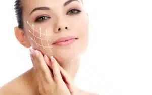 Thread lift or Rhytidectomy