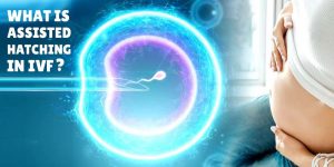 What is assisted hatching in IVF ?