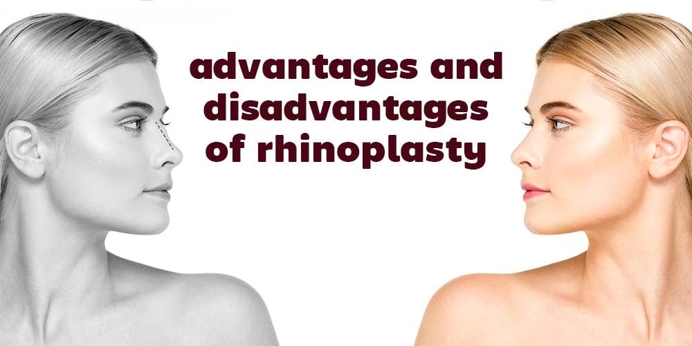 advantages and disadvantages of rhinoplasty