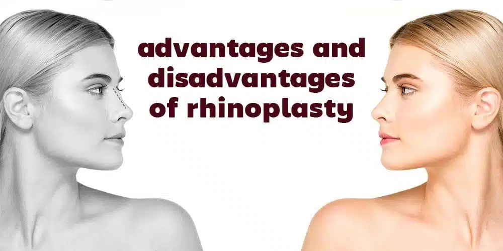 advantages and disadvantages of rhinoplasty