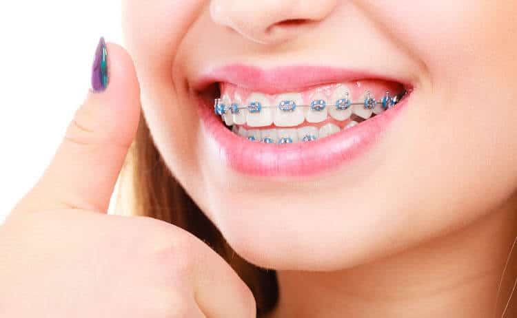 Iran, a unique destination in the field of Hollywood smile and Brace