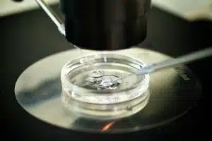 Facts About Egg Donation