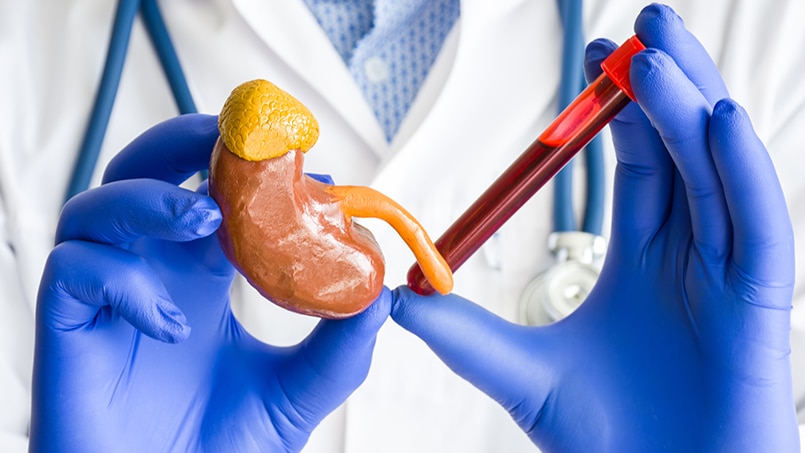 Kidney Transplant Patients and Covid-19