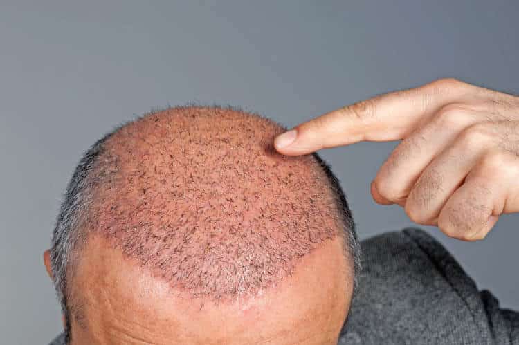 Is my Hair Growing Healthy?