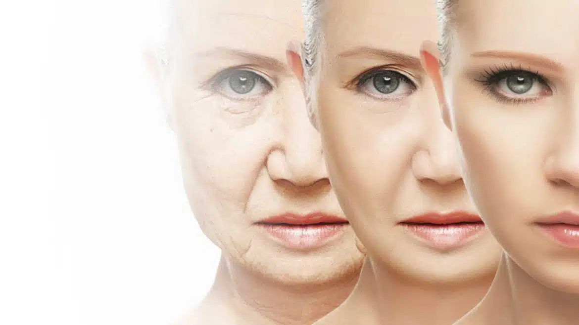Cosmetic plastic surgery in Iran