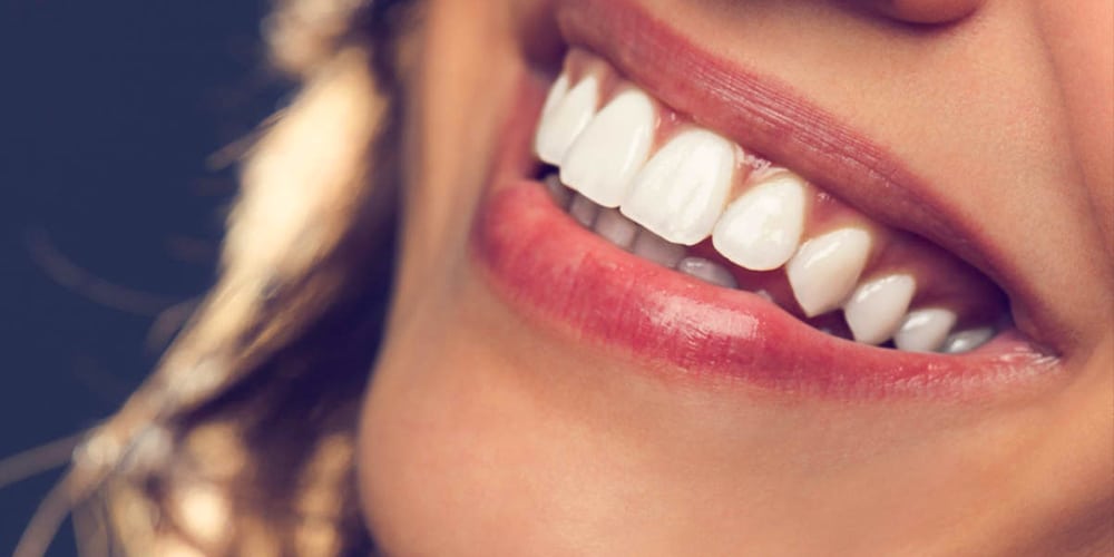 How Long Does Hollywood Smile Last?