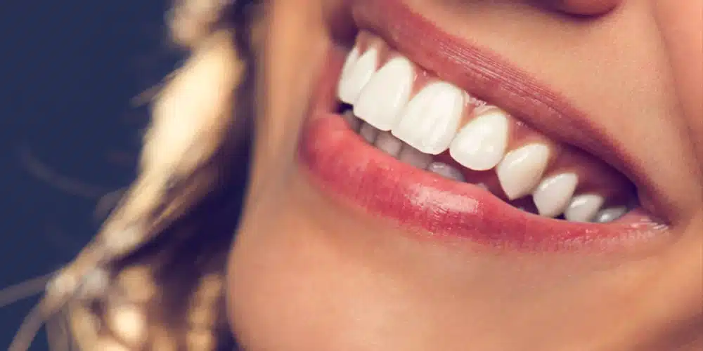 How Long Does Hollywood Smile Last?