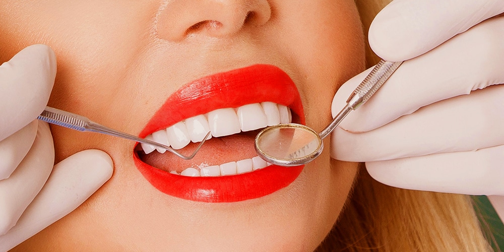 Hollywood Smile Procedure Step by Step