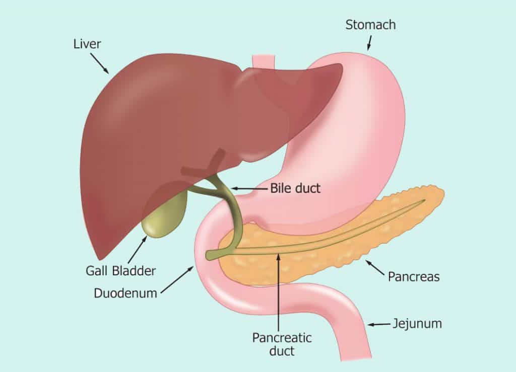 Laparoscopic cholecystectomy in Iran
