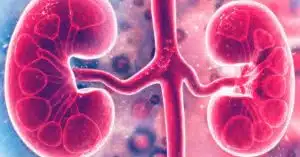 Recovery after kidney transplant