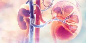 Reasons for Kidney Transplant Rejection