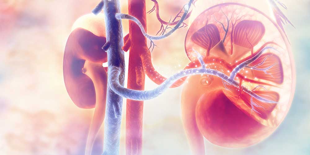 Reasons for Kidney Transplant Rejection