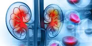 Kidney Transplant Testing in Iran