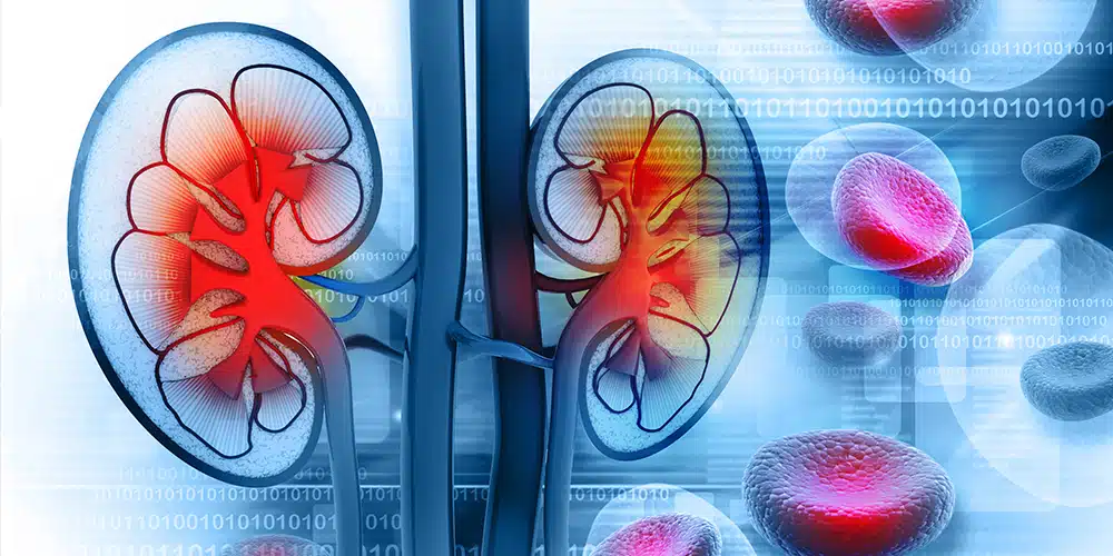 Kidney Transplant Testing in Iran