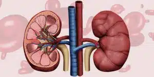 Incompatible Blood Type Kidney Transplants