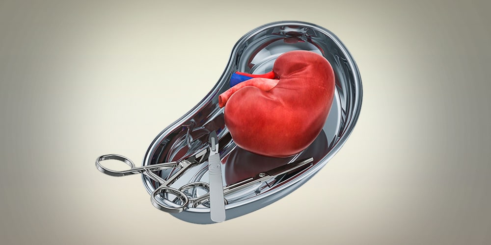 Cost of Kidney Transplant around the World