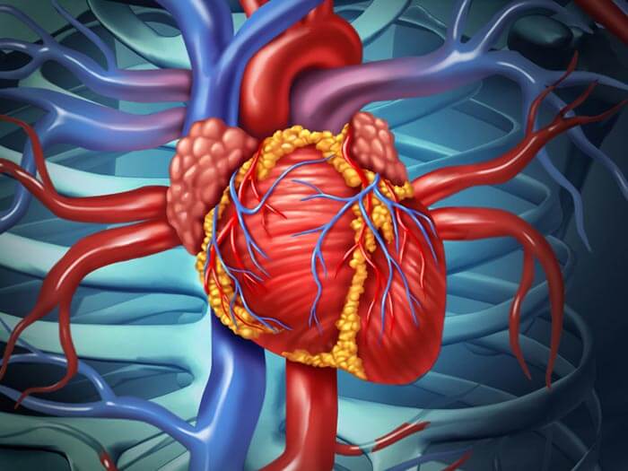 Open Heart Surgery or CABG in Iran