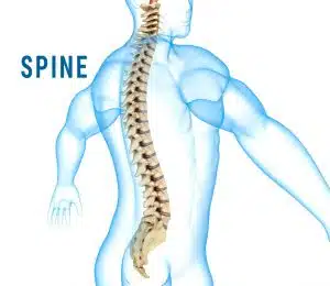 Spinal stenosis