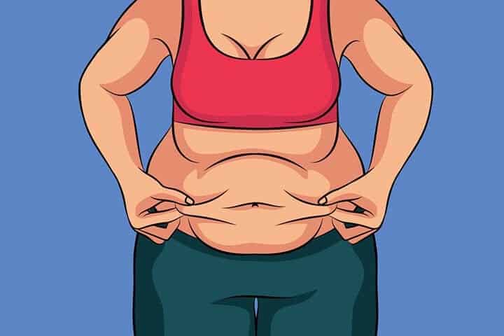جراحة تخفيف الوزن بطريقة تكميم المعدة (SLEEVE) في ايران