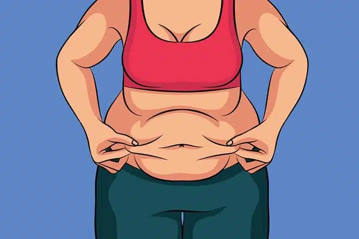 جراحة تخفيف الوزن بطريقة تكميم المعدة (SLEEVE) في ايران