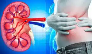 What are the common signs of kidney cancer?