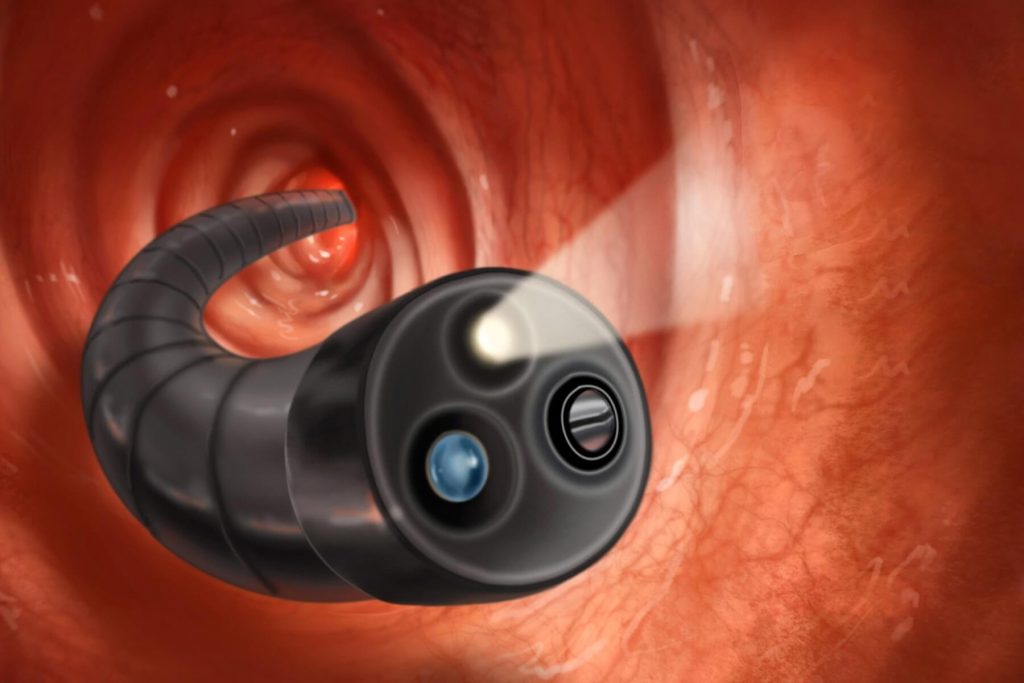 Colonoscopy in Iran
