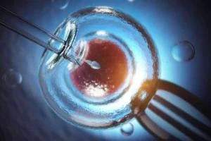 آی وی اف IVF و افزایش احتمال رخداد انواع سرطان