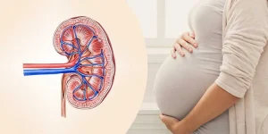 آیا پیوند کلیه بر بارداری تأثیر گذار است؟