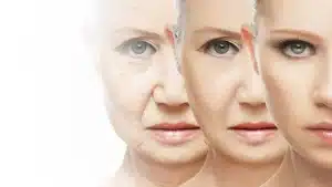 الجراحة التجميلية