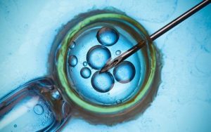 جدول زمانی آی وی اف (IVF)