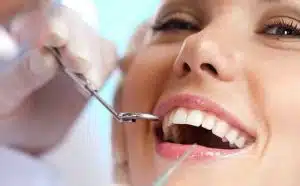 حشوة الأسنان الكومبوزيت أو الحشوة الضوئية