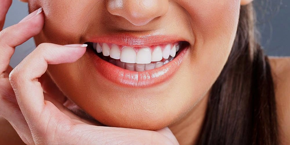 طرح لبخند هالیوودی چقدر دوام خواهد داشت؟