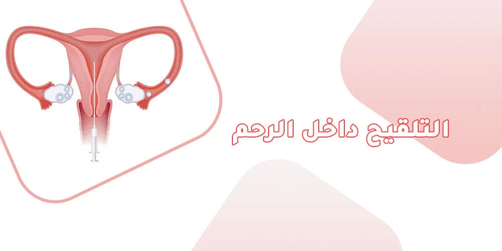ما هو التلقيح داخل الرحم وهل هي خطيرة ؟