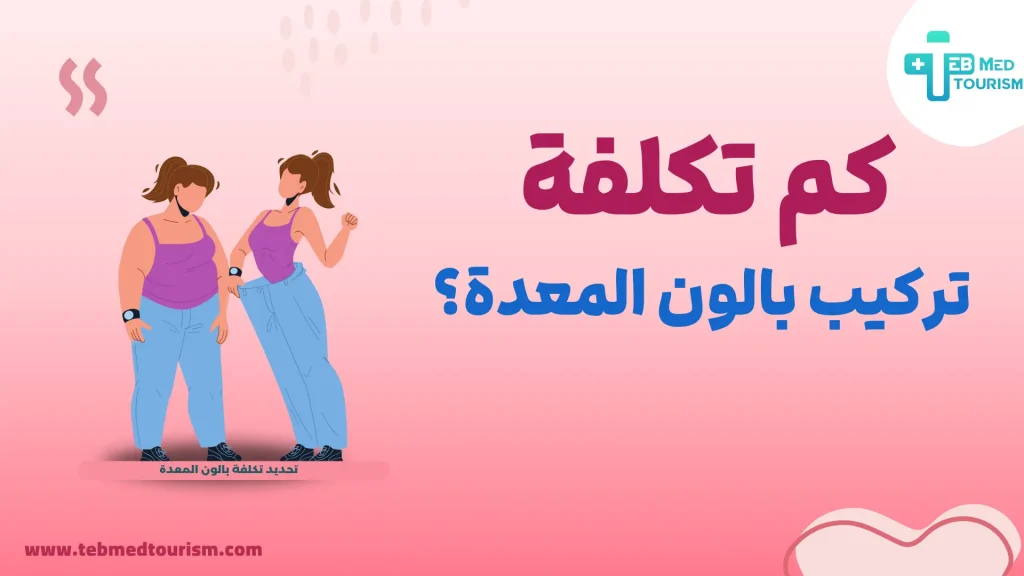 كم تكلفة تركيب بالون المعدة؟
