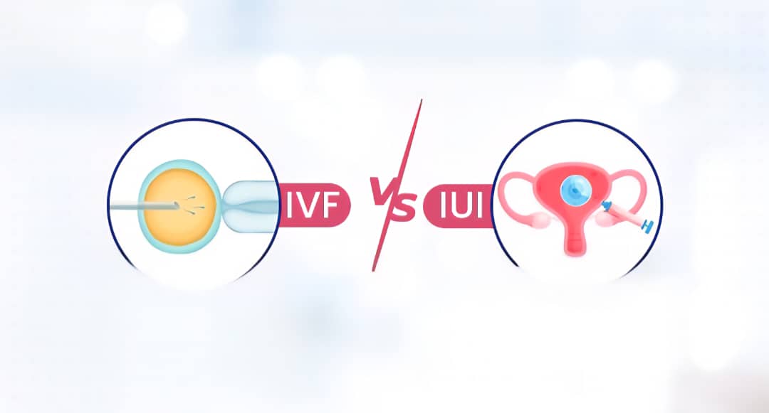ivf effects and iui side effects