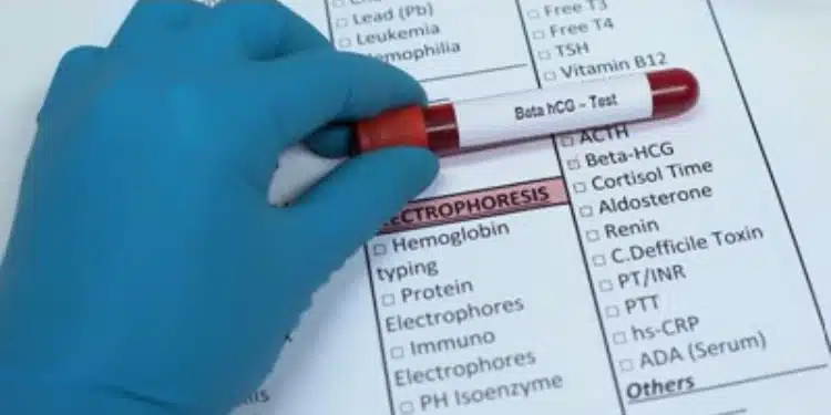 إن إجراء الاختبارات الصحيحة قبل محاولة التلقيح الصناعي يزيد من نسبة نجاح أطفال الأنابيب