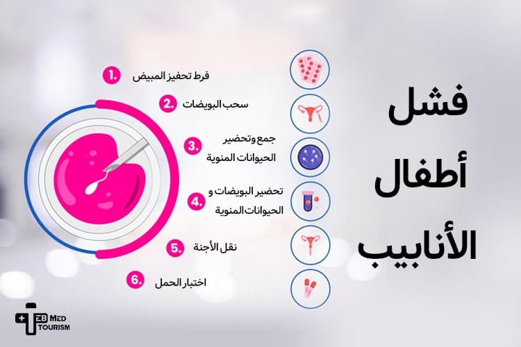 في أي مرحلة تفشل عملیة أطفال الأنابیب؟