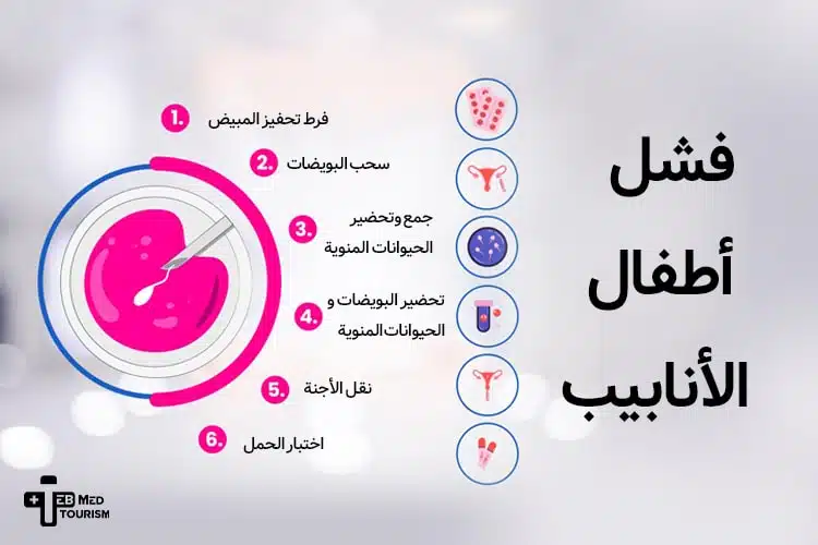 في أي مرحلة تفشل عملیة أطفال الأنابیب؟
