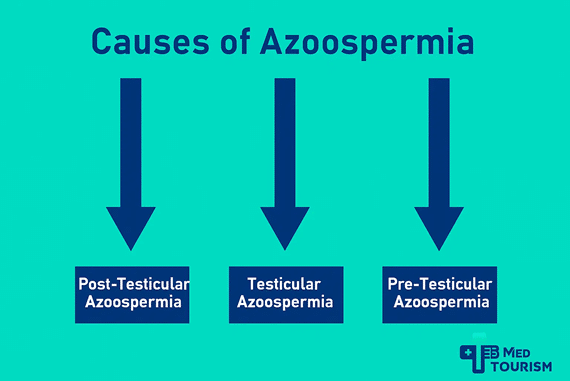 One of the most common azoospermia causes is obstruction or blockage, although other causes include hormone imbalances or genetics.