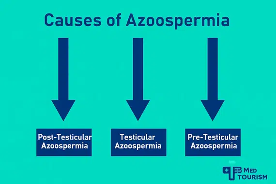 One of the most common azoospermia causes is obstruction or blockage, although other causes include hormone imbalances or genetics.