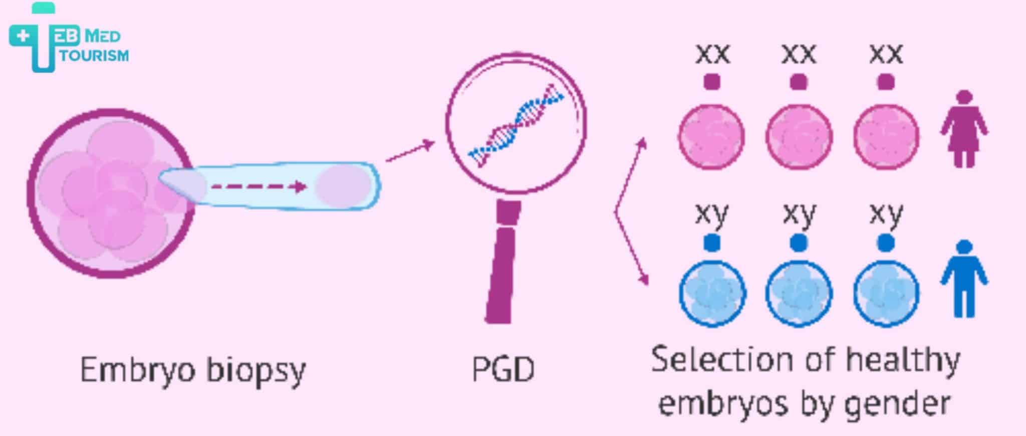 IVF-এর মাধ্যমে কি শিশুর লিঙ্গ নির্ধারণ করা সম্ভব?