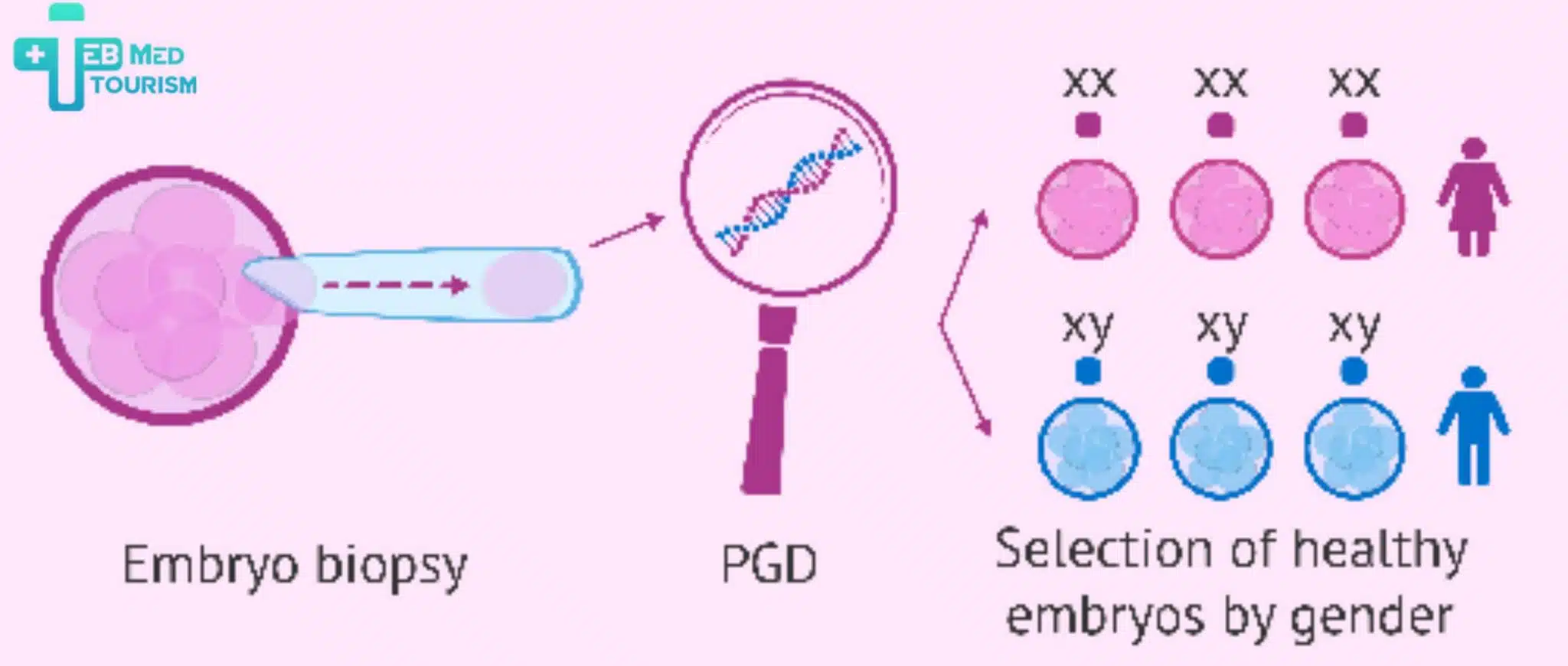 IVF-এর মাধ্যমে কি শিশুর লিঙ্গ নির্ধারণ করা সম্ভব?