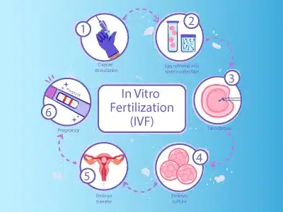 ইরানে IVF করার চ্যালেঞ্জগুলি কী কী?