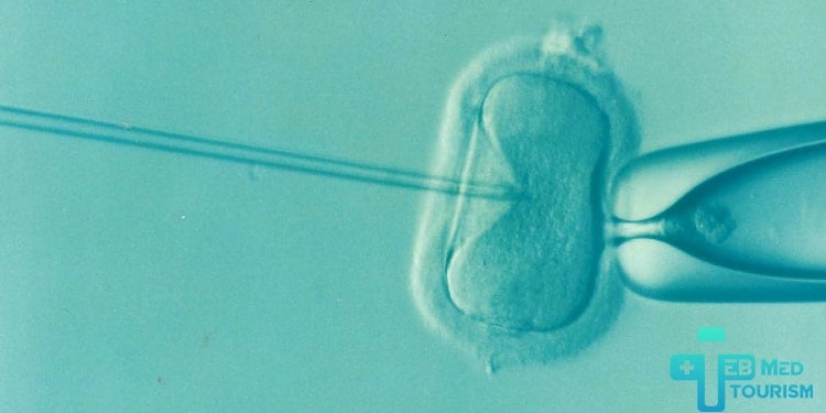 هل يجوز إجراء عملية اطفال الانابيب في الاسلام؟