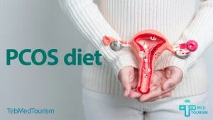 What are the requirements of a PCOS diet?