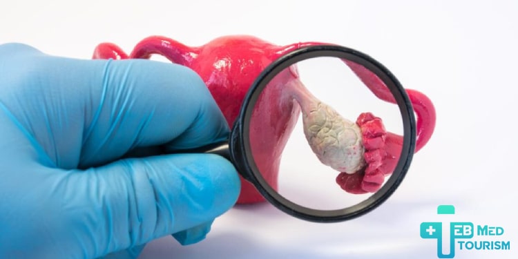 ما هي أسباب العقم عند النساء؟