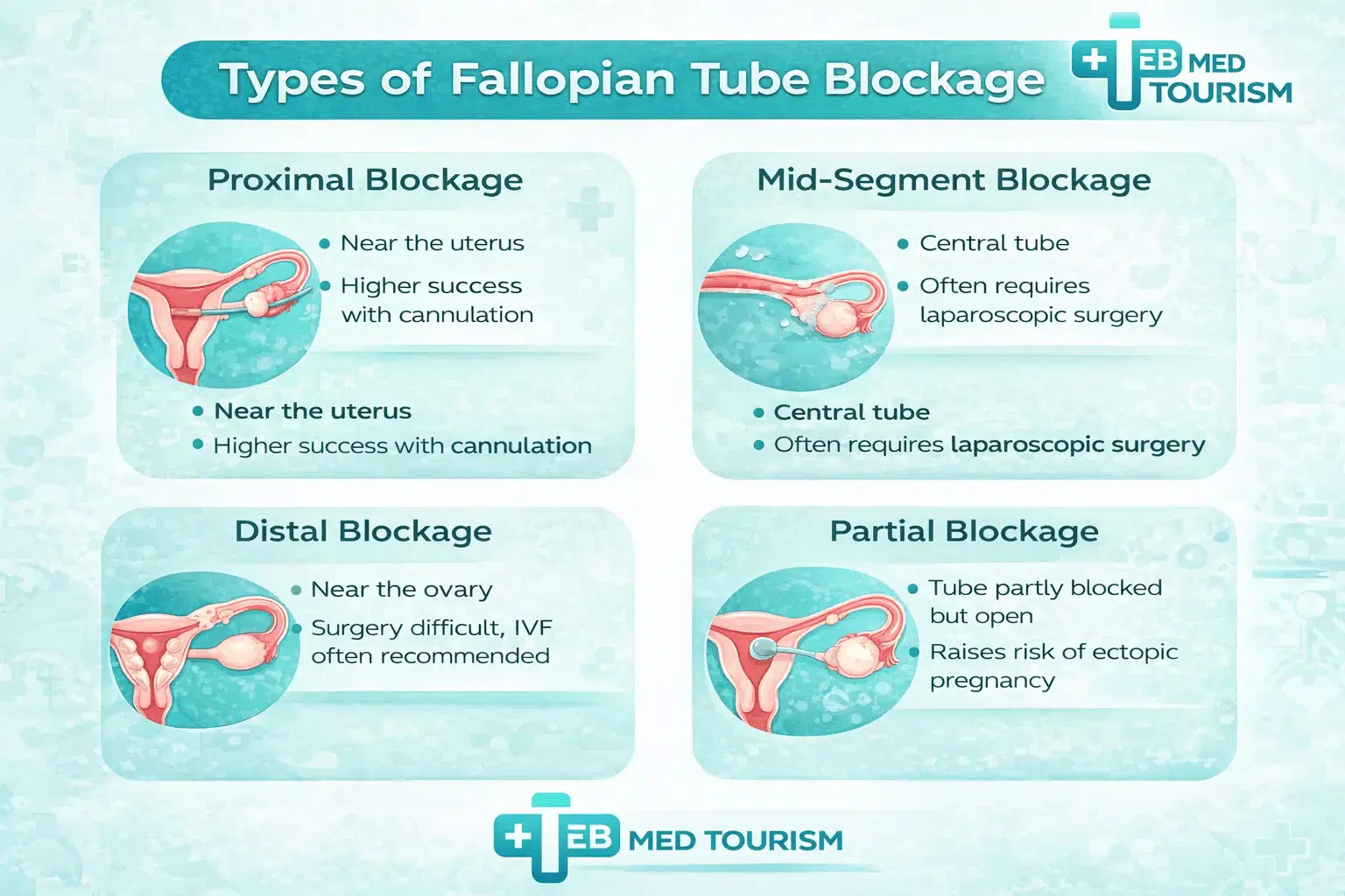 What are the types of blockage of fallopian tubes?