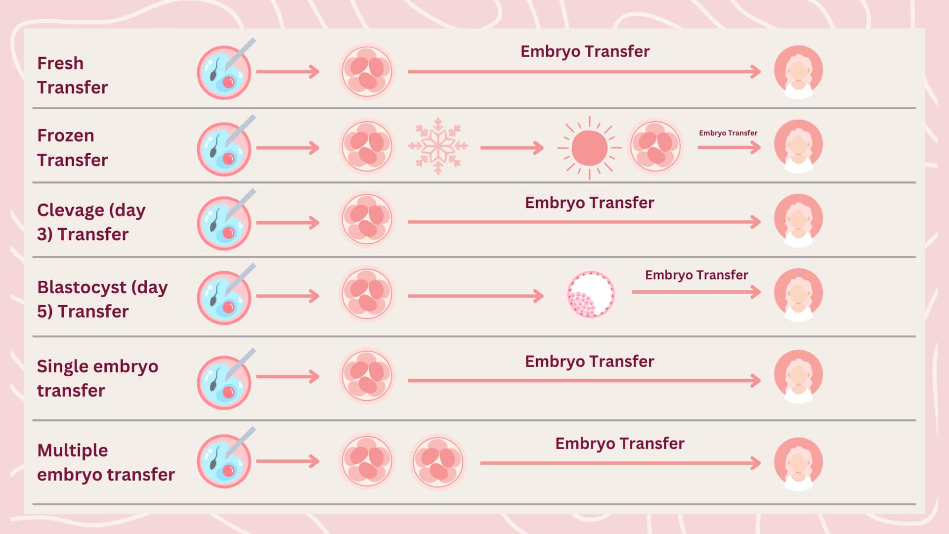 what are the typrs of embryo transfer?