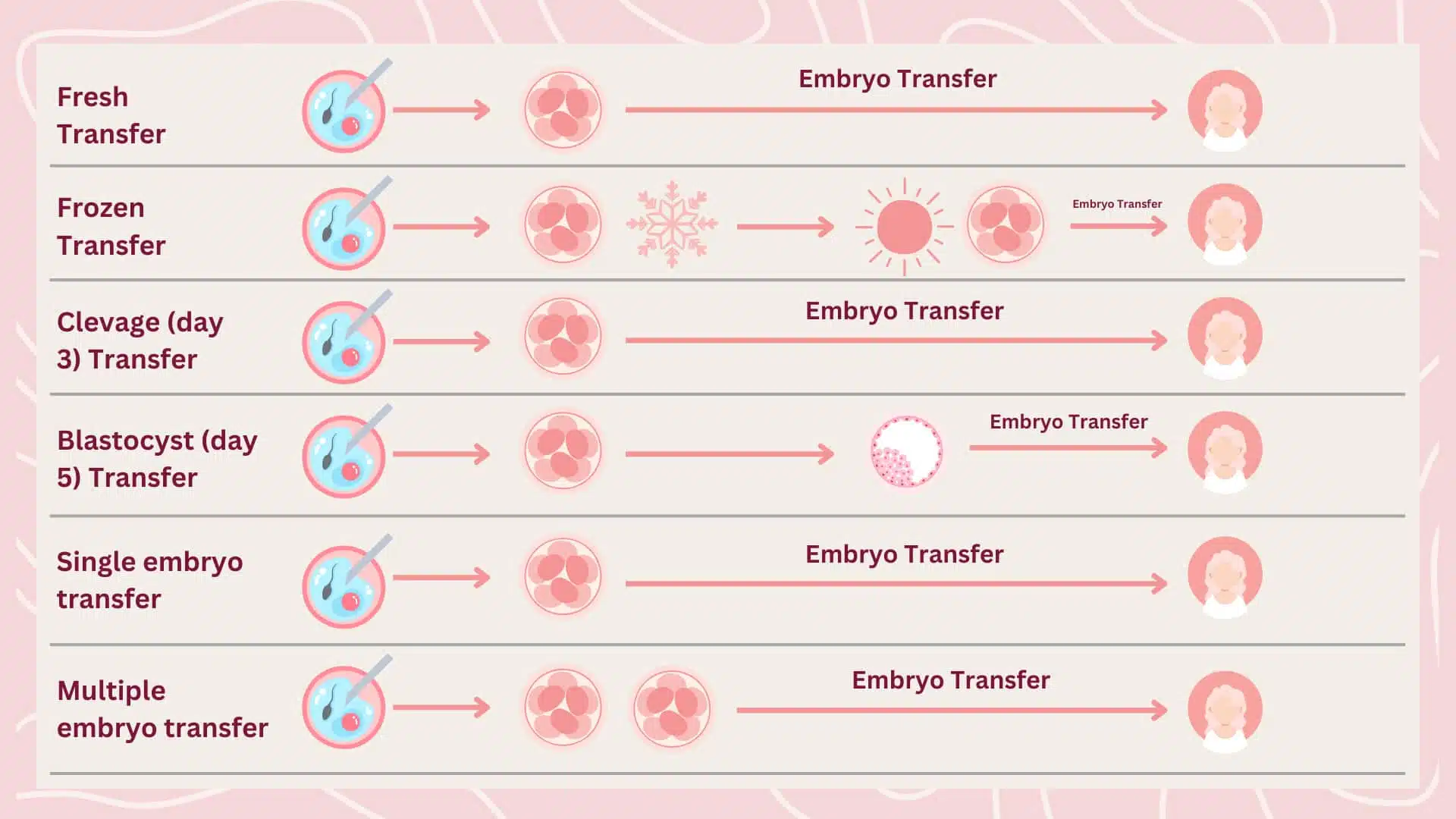 what are the typrs of embryo transfer?
